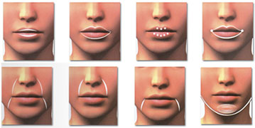 Fillers-injections-Tunisia